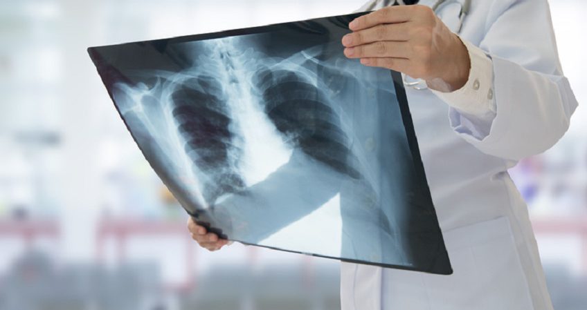 Técnico Superior en Imagen para el Diagnóstico y Medicina Nuclear