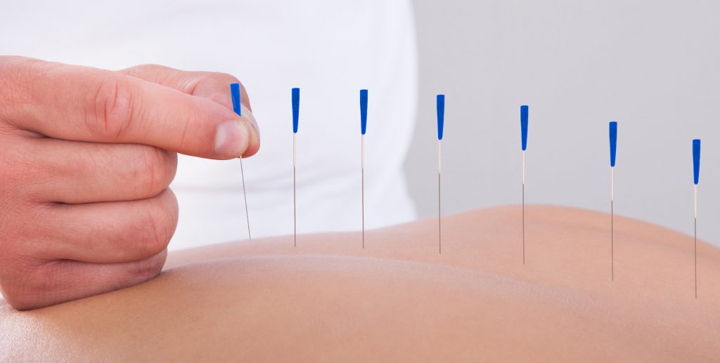 Curso de acupuntura