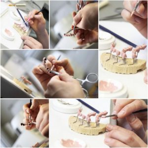 Detalle sobre en qué consiste el trabajo de un protésico dental