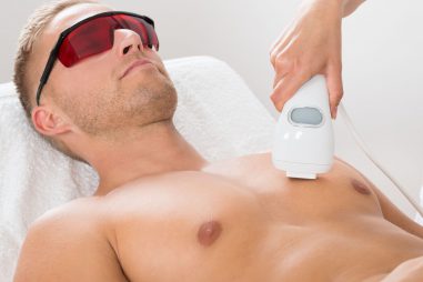 Fotodepilación y láser