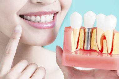 Máster en osteointegración: qué es y dónde puedes cursarlo