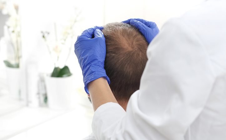 Curso de tricología: qué es y dónde puedes hacerlo